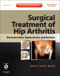 Surgical Treatment Of Hip Arthritis Reconstruction, Replacement, and Revision