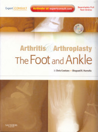 Arthritis & Arthroplasty The Foot and Ankle
