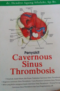 Penyakit Cavernous Sinus Thrombosis